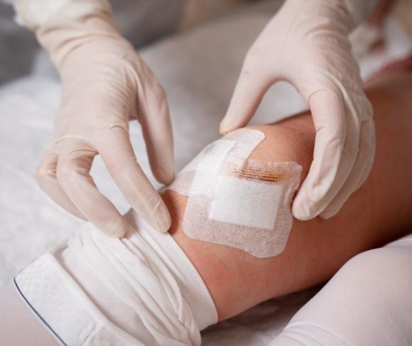 Soins de plaies à domicile